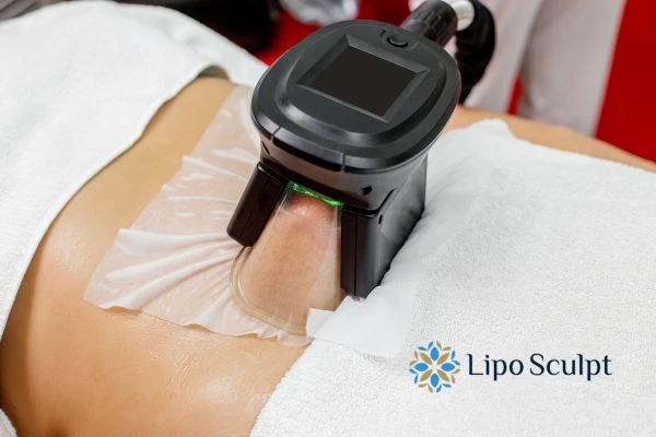 Does Fat Freezing at Home Work? DIY Devices vs Professional Cryolipolysis 1 How is professional cryolipolysis different Owsestry?
