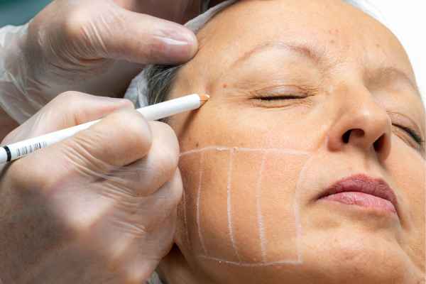 CryoPen: 5 Skin Concerns It May Be Used to Treat 4 What should you ask before having CryoPen treatment Owsestry?