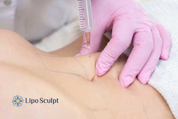 Aqualyx for Muffin Tops: What to Know Before Fat-Dissolving Injections 4 Are there risks Owsestry?