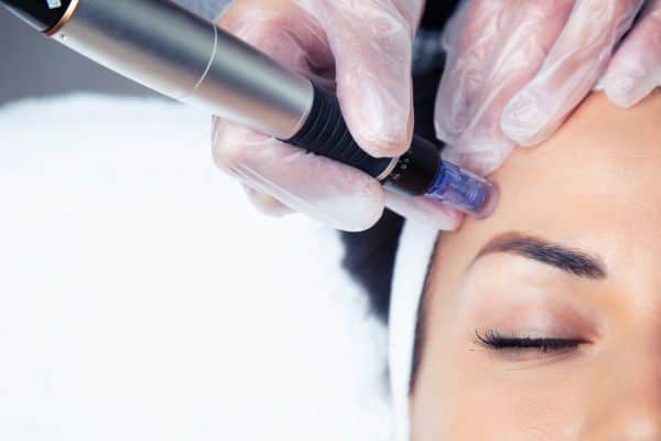 Explaining Total Skin Tightening Treatment and What to Expect 2 What Skin Concerns Can Total Skin Tightening Treatment Help With Owsestry?